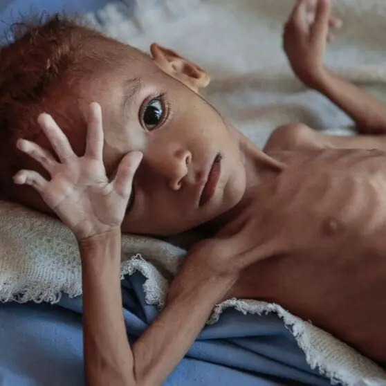 syrian_babies_on_the_brink_of_starvation_desktop